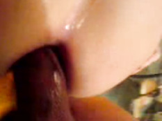 Private anal