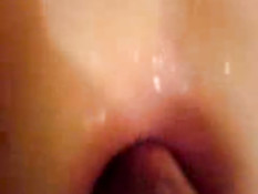 Private anal