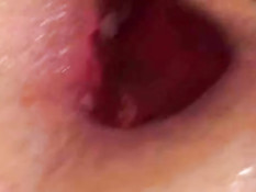 Amazing gape