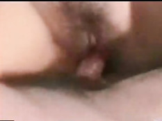 Hairy genitals 2