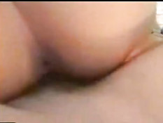 Hairy genitals 2