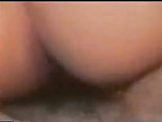 Hairy genitals 2