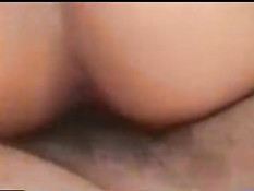 Hairy genitals 2