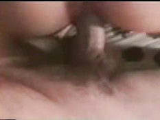 Hairy genitals 1