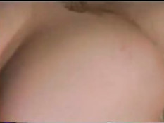 Hairy genitals 1